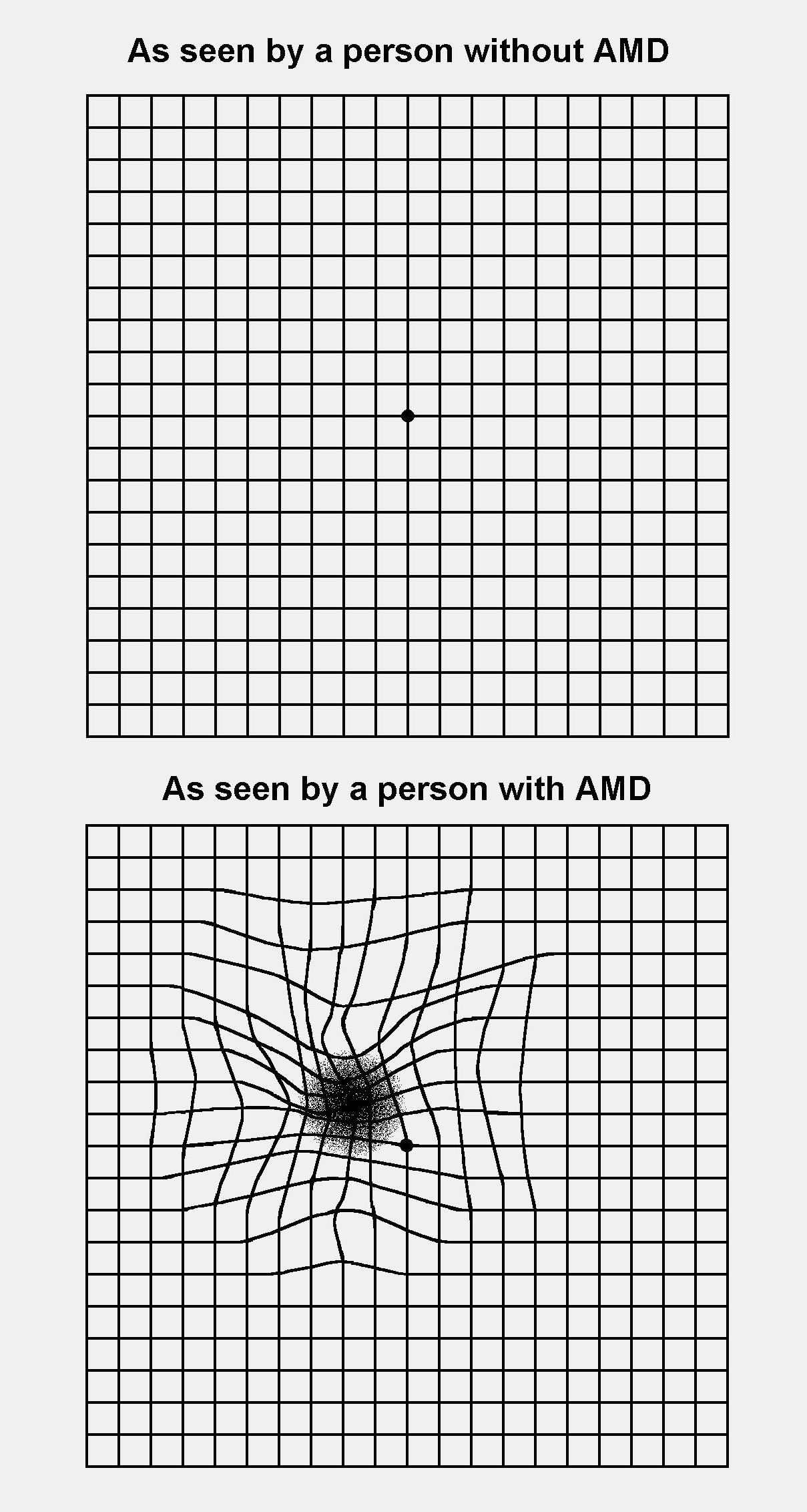 Amsler Grid